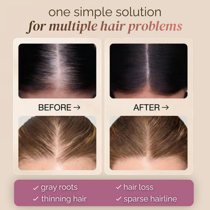 🔥LAST DAY 60% OFF Buy 1 Get 1 Free🔥 hair concealer