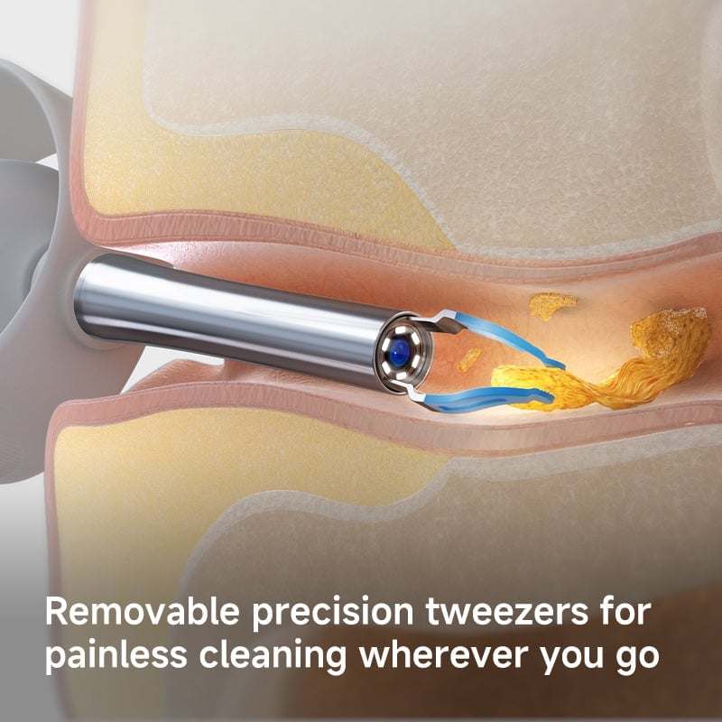 Wireless Endoscopic Ear Scoop👂