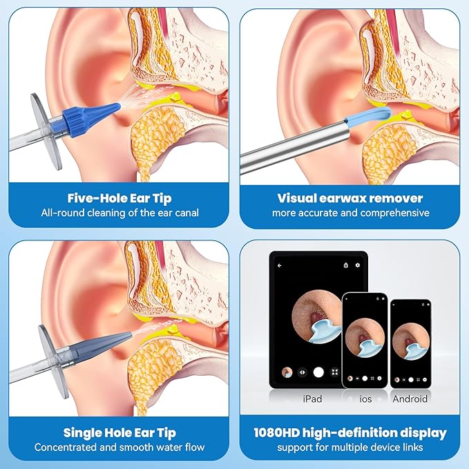 Wireless Endoscopic Ear Scoop👂