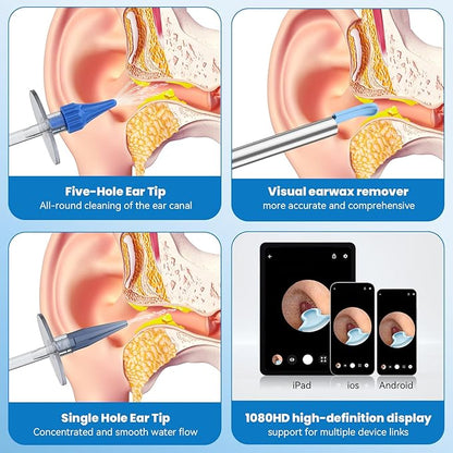 Wireless Endoscopic Ear Scoop👂