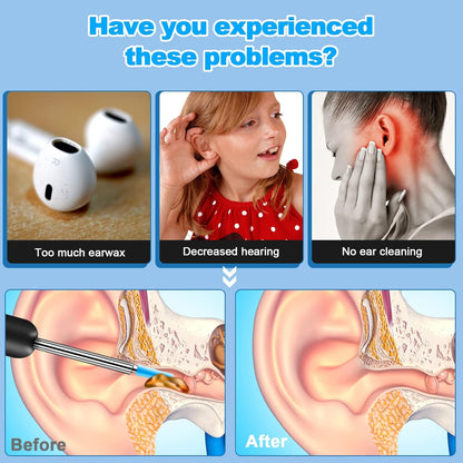 Wireless Endoscopic Ear Scoop👂