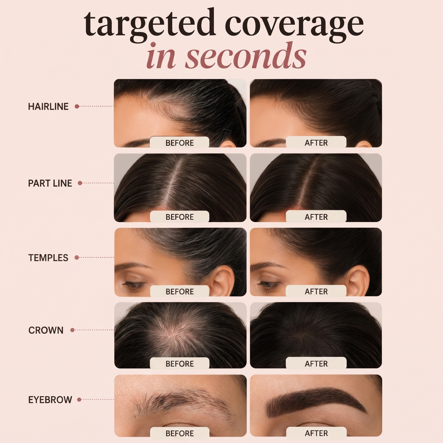 🔥LAST DAY 60% OFF Buy 1 Get 1 Free🔥 hair concealer
